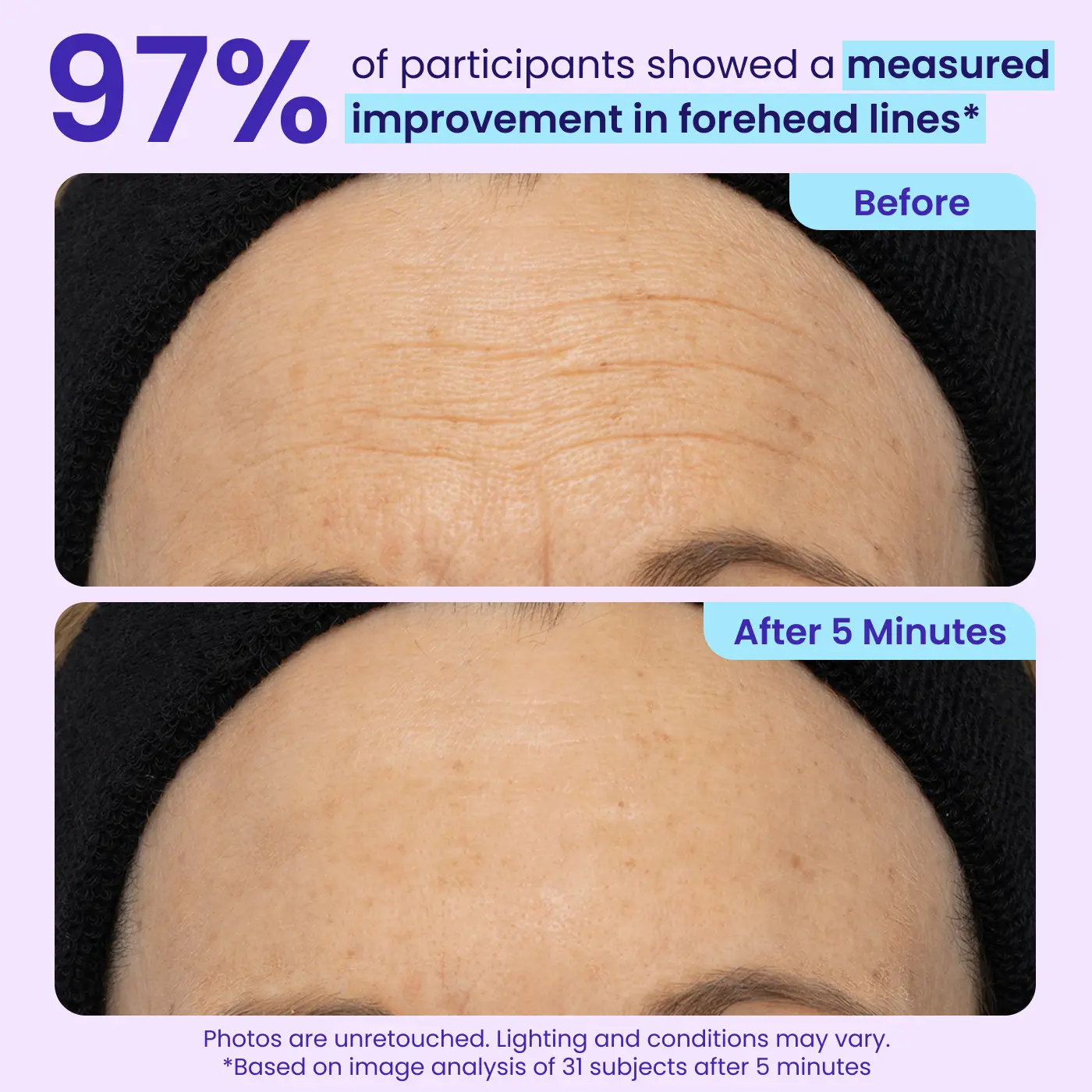 Erase Eye Bags in Minutes — Look Refreshed Instantly
