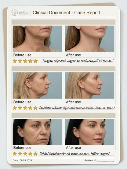 🔥BIG SALE-50% OFF✨Roller Anti-Aging Lift Cream – Elevate Your Neck Care Routine ✨